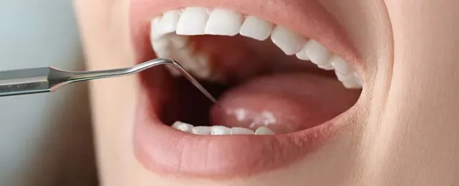 Periodontal Treatment Cost in Woodbridge, VA (2026 Guide)
