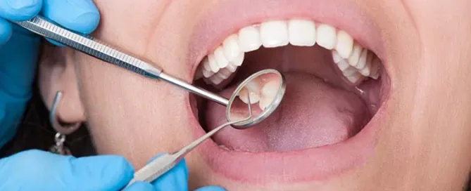 Tooth Extraction Aftercare in Woodbridge, VA