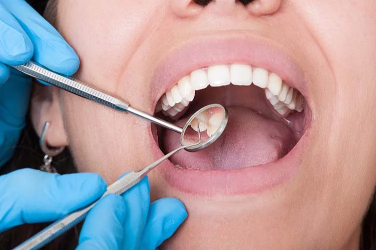 Tooth Extraction Aftercare in Woodbridge, VA