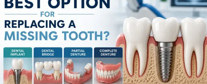What Is the Best Option for Replacing a Missing Tooth in Virginia?
